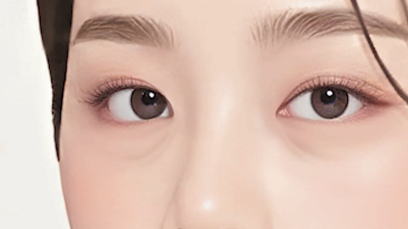 레이저 원리 이미지